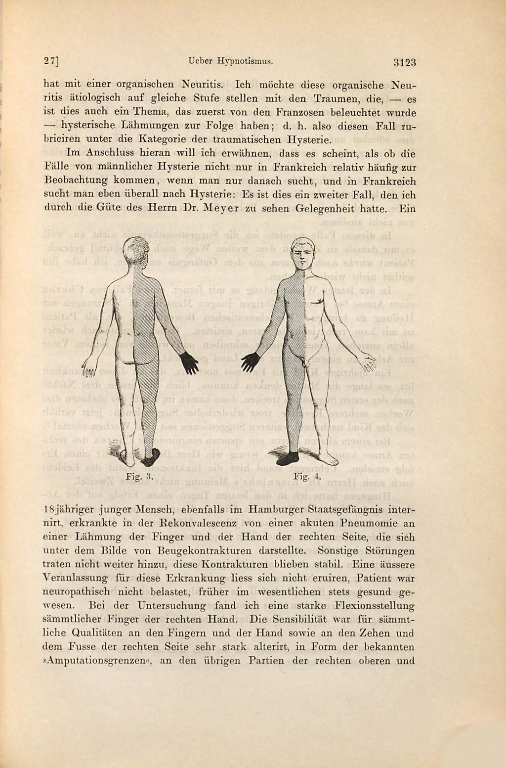 Cover of Über Hypnotismus